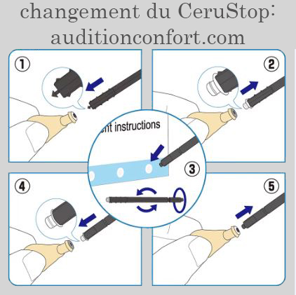 changement cerustop.JPG